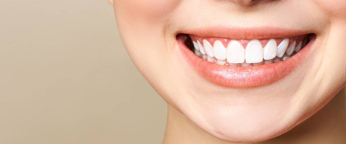 Dental Sealants in Norwood