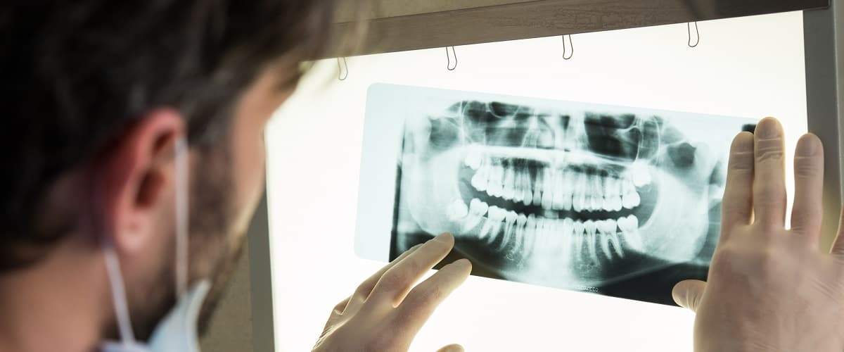  Digital X-rays in Norwood